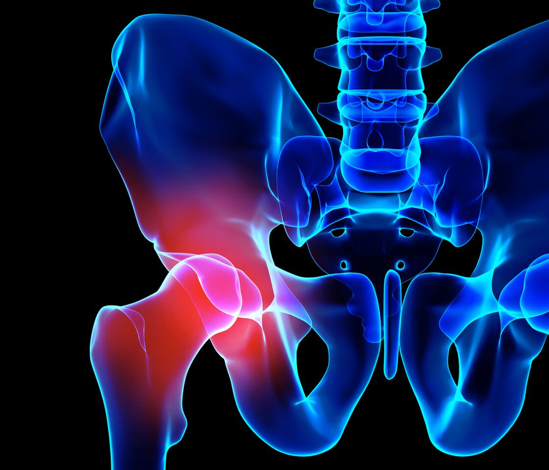 Core Decompression ? Diagnosis And Treatment