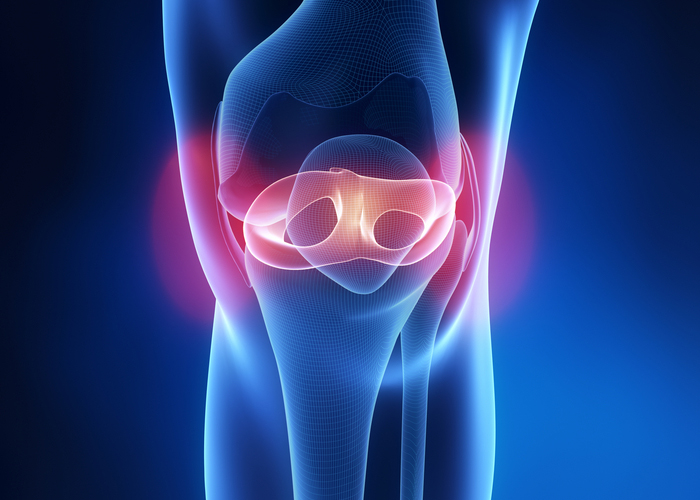 Meniscus Tear