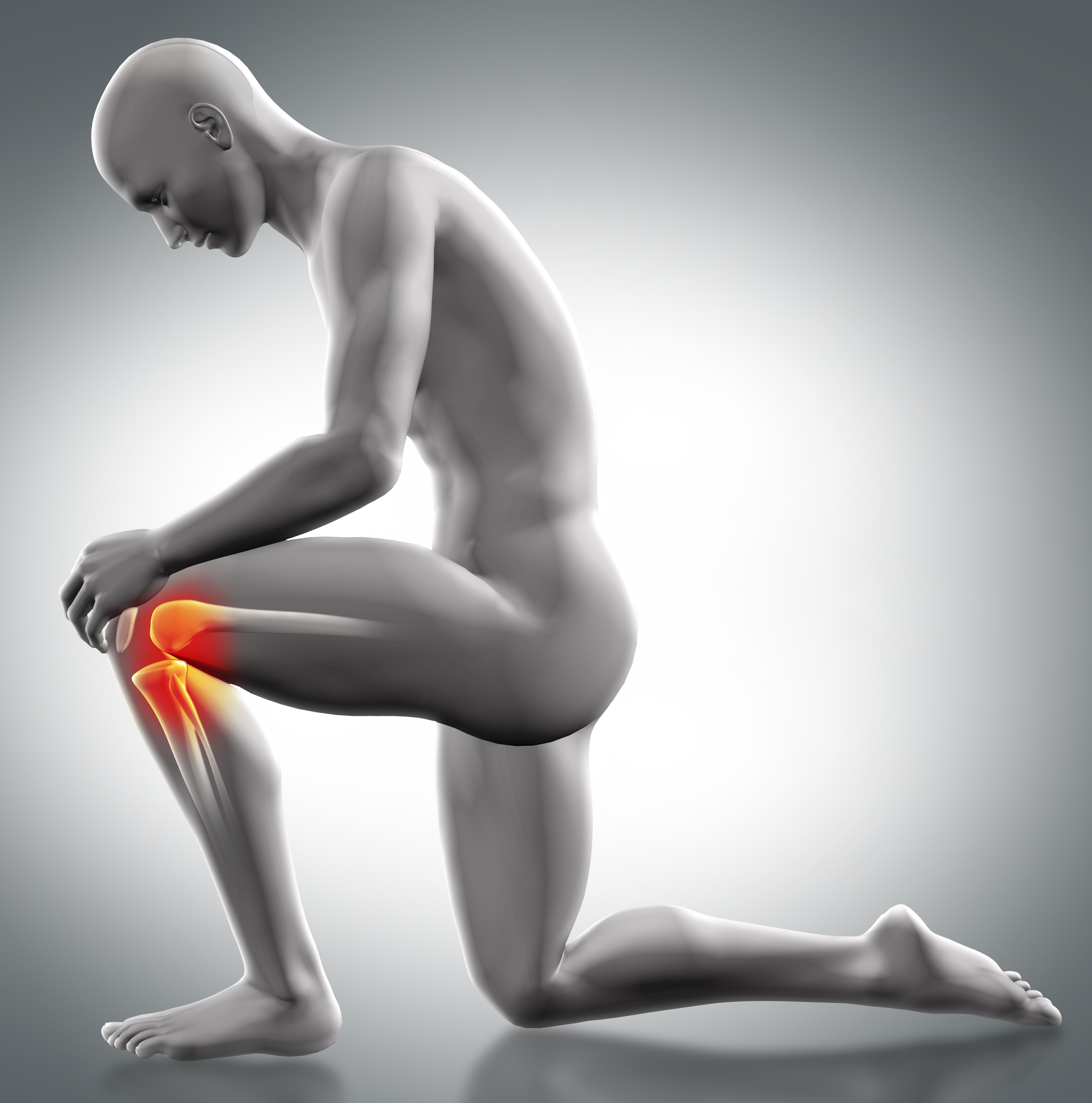PCL Tear ? Causes Symptoms & Treatment