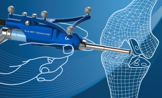 Robotic Knee Surgery & Surgical Procedure