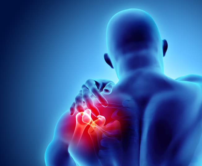 Hip replacement