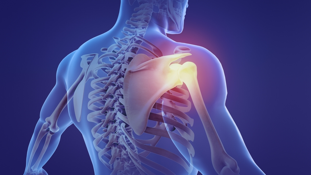Shoulder Fractures